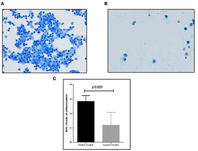 Semaphorin 3A Is Effective in Reducing Both Inflammation and Angiogenesis in a Mouse Model of Bronchial Asthma